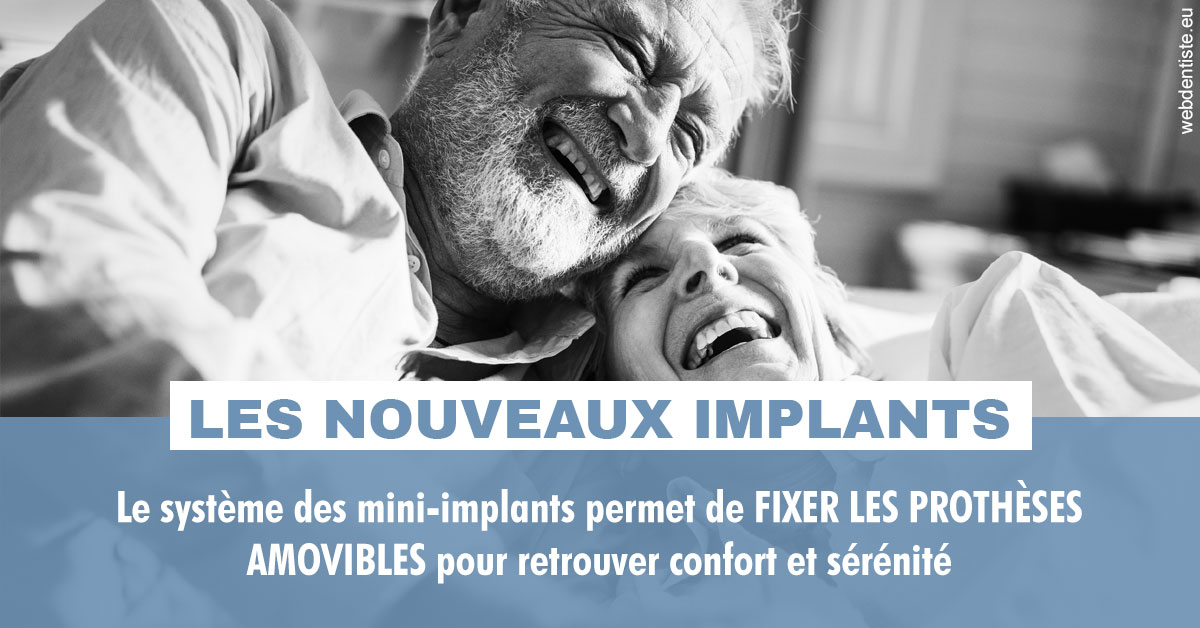https://dr-lenouvel-isabelle.chirurgiens-dentistes.fr/Les nouveaux implants 2