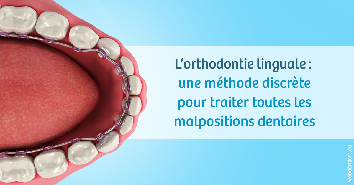 https://dr-lenouvel-isabelle.chirurgiens-dentistes.fr/L'orthodontie linguale 1