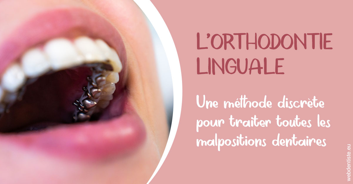 https://dr-lenouvel-isabelle.chirurgiens-dentistes.fr/L'orthodontie linguale 2