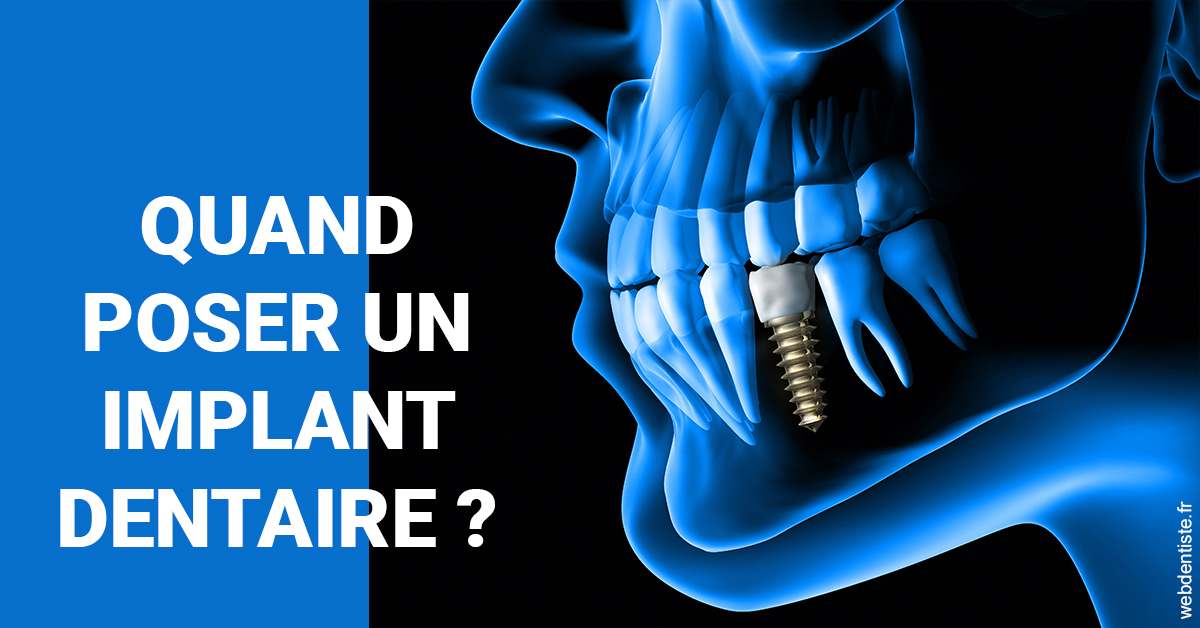 https://dr-lenouvel-isabelle.chirurgiens-dentistes.fr/Les implants 1