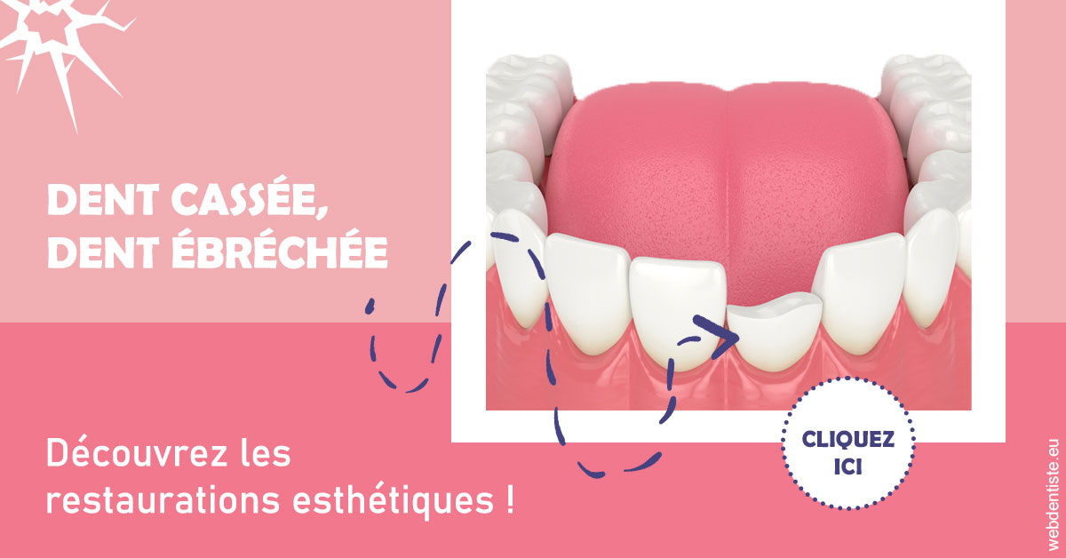 https://dr-lenouvel-isabelle.chirurgiens-dentistes.fr/Dent cassée ébréchée 1
