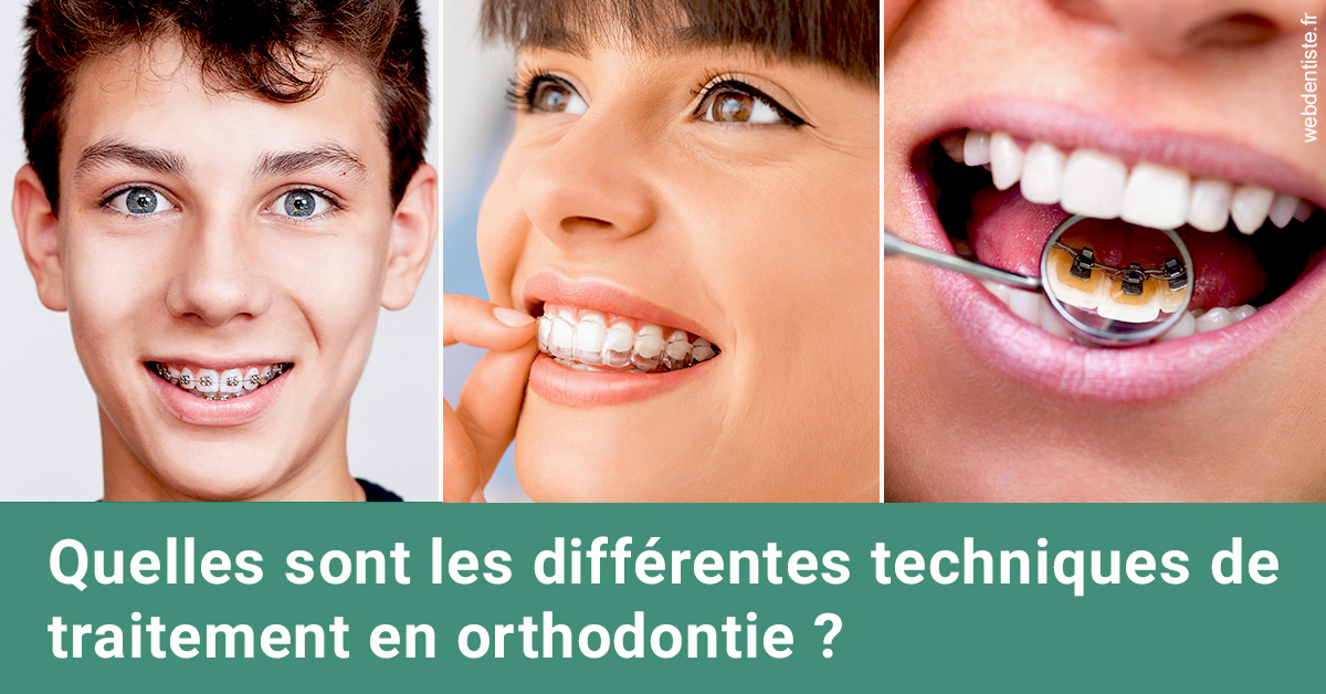 https://dr-lenouvel-isabelle.chirurgiens-dentistes.fr/Les différentes techniques de traitement 2
