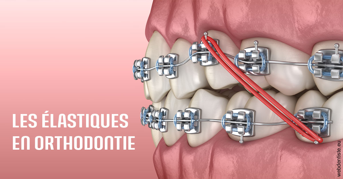 https://dr-lenouvel-isabelle.chirurgiens-dentistes.fr/Elastiques orthodontie 2