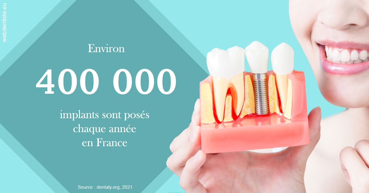 https://dr-lenouvel-isabelle.chirurgiens-dentistes.fr/Pose d'implants en France 2